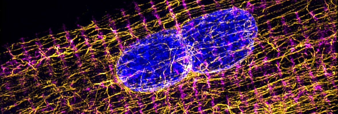 Image of CVI research