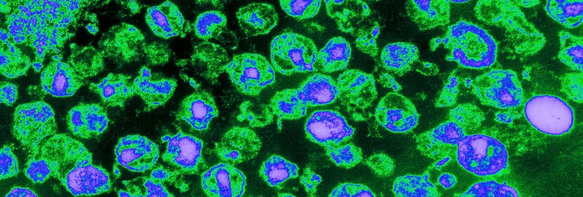 colorized HIV cells